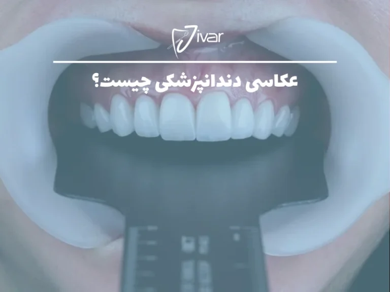 عکاسی دندانپزشکی